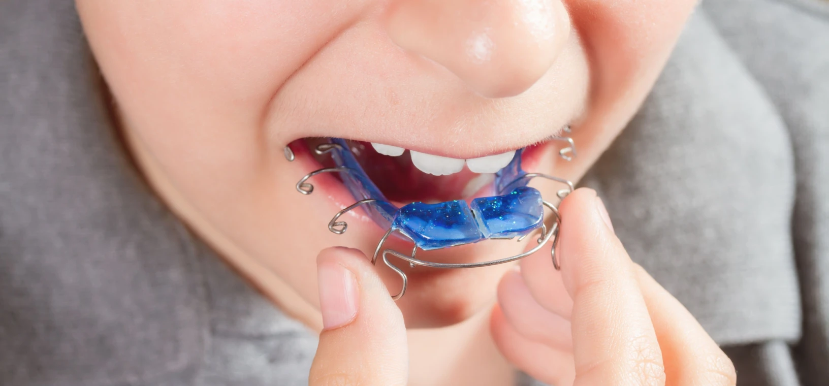 orthodontie enfant