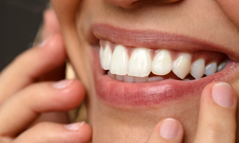 Séance de blanchiment des dents à Rodez